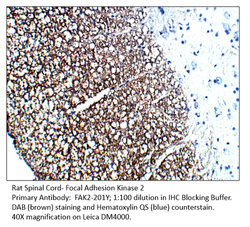 FAK2 Antibody from Fabgennix