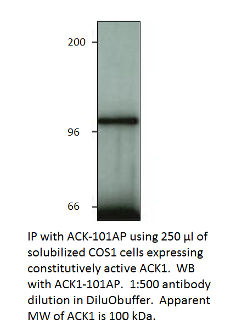 ACK1 Blocking Peptide from Fabgennix