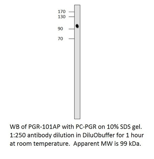 Progesterone Receptor Positive Control from Fabgennix