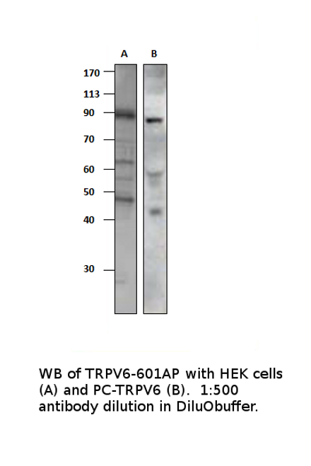 TRPV6 Positive Control from Fabgennix