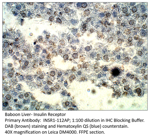 Insulin Receptor Antibody from Fabgennix