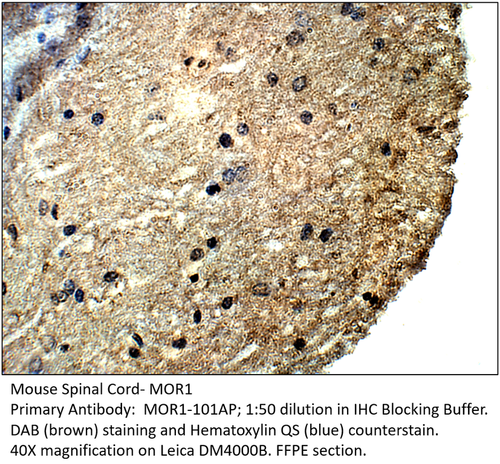 MOR1 Antibody from Fabgennix