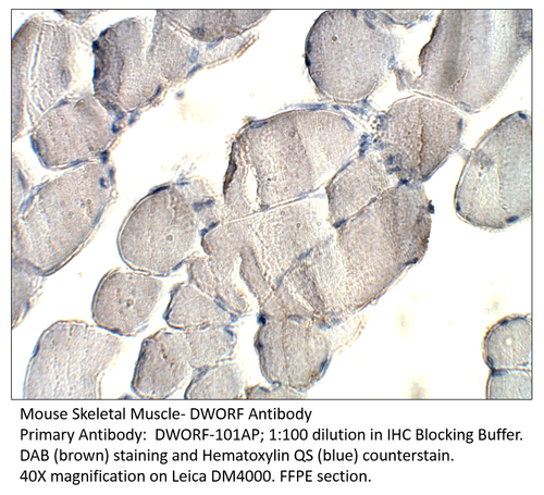 DWORF Antibody from Fabgennix