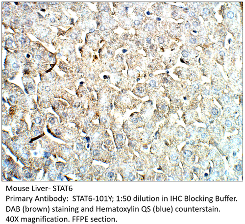 STAT6 Antibody from Fabgennix