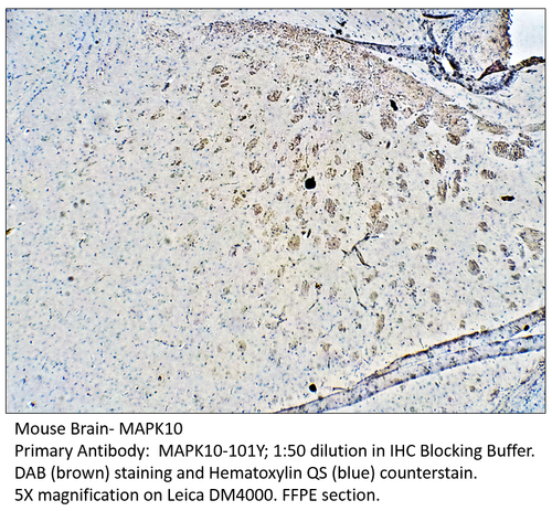MAPK10 Antibody from Fabgennix