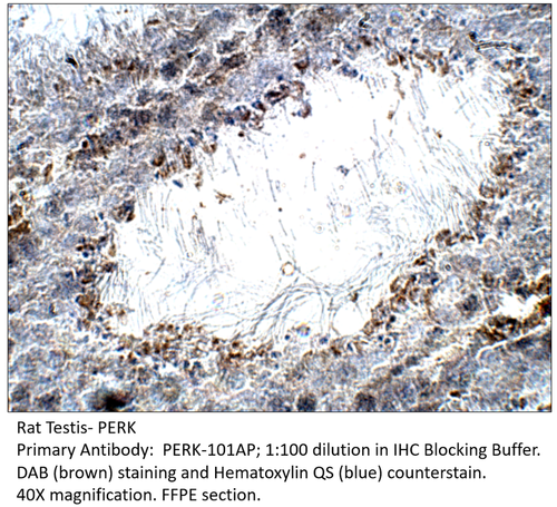 PERK Antibody from Fabgennix