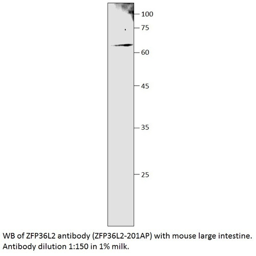 ZFP36L2 Antibody from Fabgennix