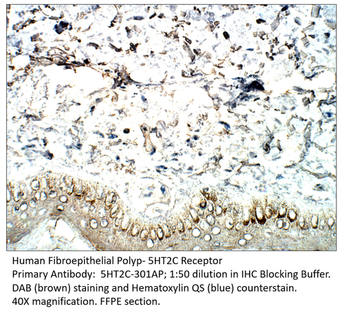 5HT2C Receptor Antibody from Fabgennix