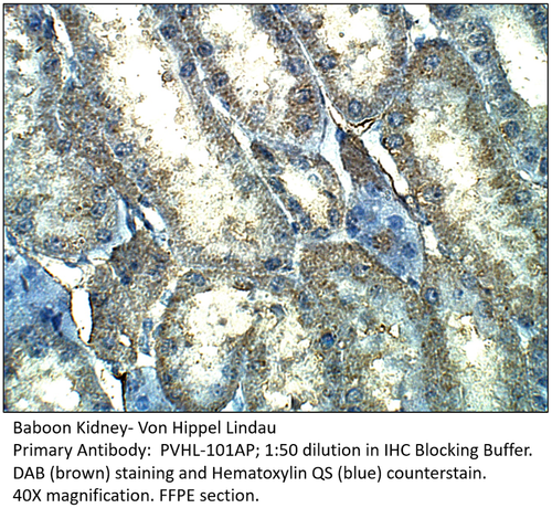 Von Hippel Lindau Antibody from Fabgennix