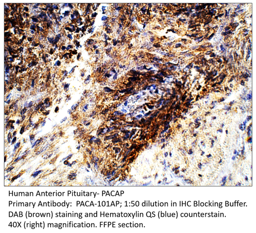 PACAP Antibody from Fabgennix