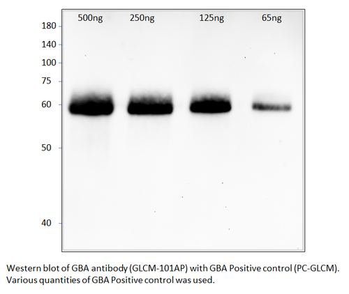 GBA Positive Control from Fabgennix