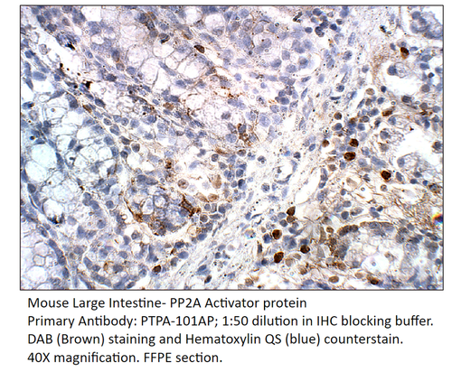 PP2A Activator protein Antibody from Fabgennix