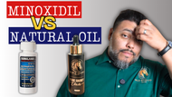 Minoxidil vs Natural Oils: What I Learned After Using Both (Real Results)