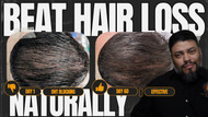 Wild Stallion Mane & The Truth About Hair Growth (And the #1 Reason Most Products Fail You)