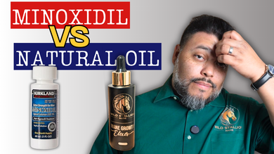 Minoxidil vs Natural Oils: What I Learned After Using Both (Real Results)