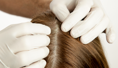 7 Powerful Scalp Health Tips for Hair Growth and Dandruff Relief