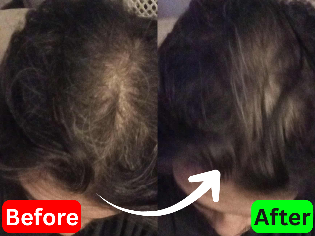 Jose before and after