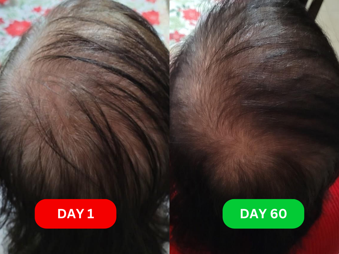 Teresa before and after