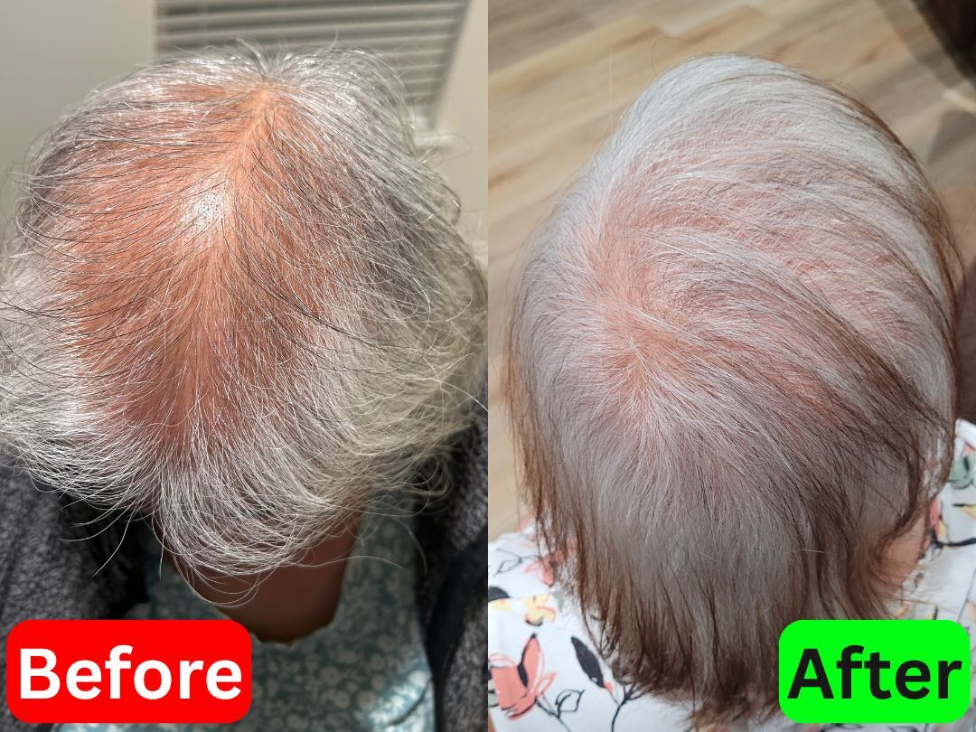 Teresa before and after