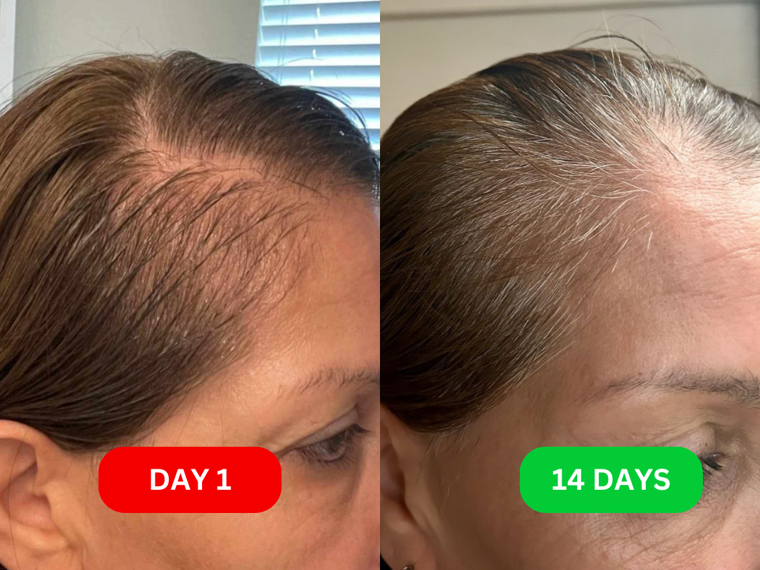 mother in law 2 weeks results