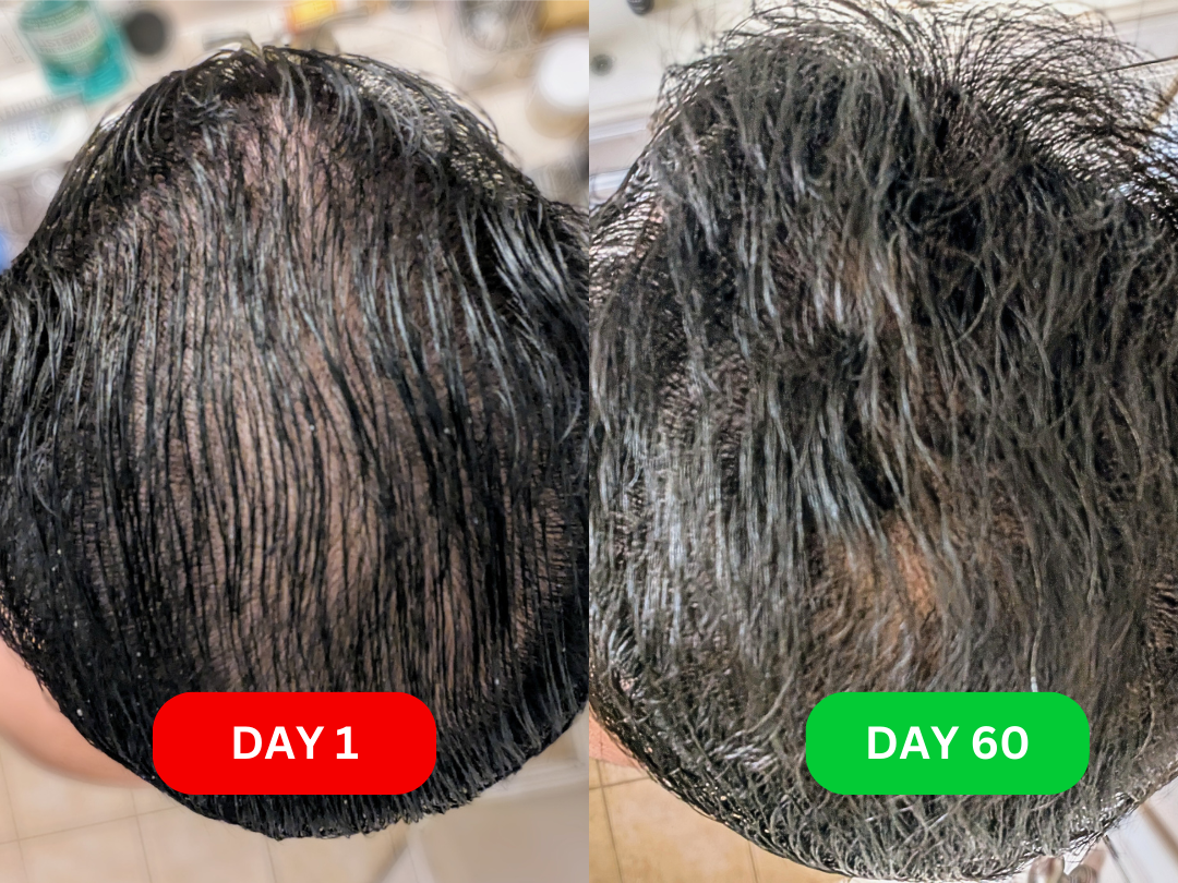 Founder before & after photo