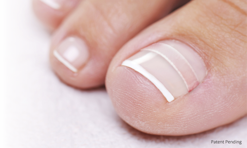 What Your Nails Say About Your Health