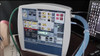 AHP300 Portable Transport Ventilator