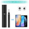 LAYADO Otoscope, Upgraded 3.9mm 1080P HD WiFi Ear Camera with 6 LED Lights and Ear Wax Removal Tool for Kids and Adults, Compatible with Android and iPhone