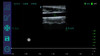 CE 128 elements linear transducer medical mini USB PW ultrasound probe SUN-P2