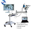 YDJ-II Series binocular vision video colposcope for gynecology