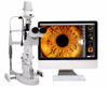 2020 Ophthalmic Slit Lamp Imaging Module Compatibility With Different Brand Slit Lamps