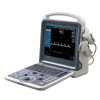 Color Doppler Ultrasound Scanner Portable Ultrasound Scanner