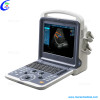 Color Doppler Ultrasound Scanner Portable Ultrasound Scanner