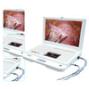 Hospital Machine Digital Video Portable Endoscope System