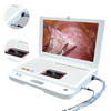 Hospital Machine Digital Video Portable Endoscope System