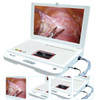 Hospital Machine Digital Video Portable Endoscope System