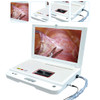 Hospital Machine Digital Video Portable Endoscope System