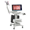 Kernel KN2200I(H) full HD sony camera digital Video Colposcope for gynecology cervix vagina examination