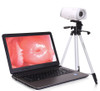 PL-9800 Video Portable Colposcope