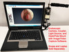 Rigid Endoscope for Stryker Hd Usb Camera and Light Source
