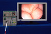 Linvatec/conmed C3134e 3ccd Camera for Surgical Use