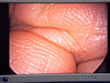 Linvatec/conmed C3134e 3ccd Camera for Surgical Use