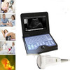 CE Digital Portable Laptop Ultrasound scanner Diagnostic machine,Convex Probe,US