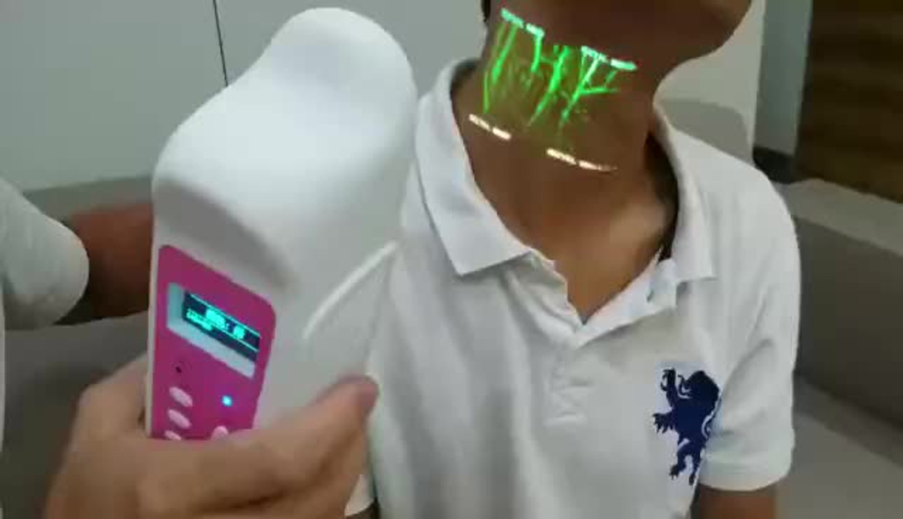 Hospital Equipment Medical Infrared Vein Viewer IV Locator