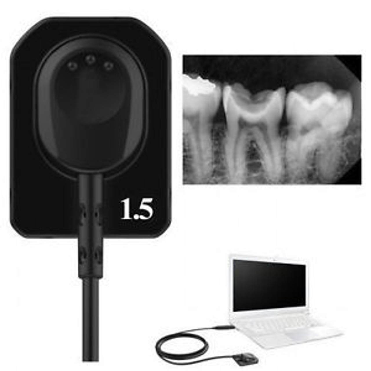 Ray購入9300 S VATECH Dental Imaging System RVG Intraoral Digital X-ray EZ