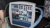 AHP300 Portable Transport Ventilator