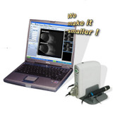 Ophthalmic Machine AB Scan Portable Ultrasound Scanner SW-2100