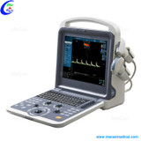 Color Doppler Ultrasound Scanner Portable Ultrasound Scanner