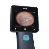 MIIS Horus Otoscope -EOC100 Video Otoscope For Ear Canal Detection