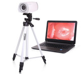 PL-9800 Video Portable Colposcope
